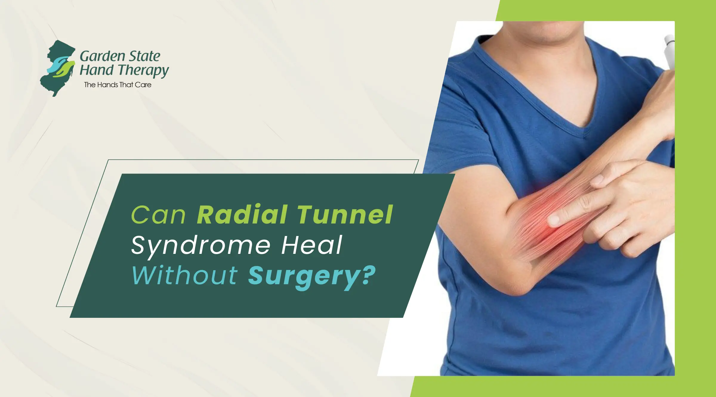 Can Radial Tunnel Syndrome Heal Without Surgery