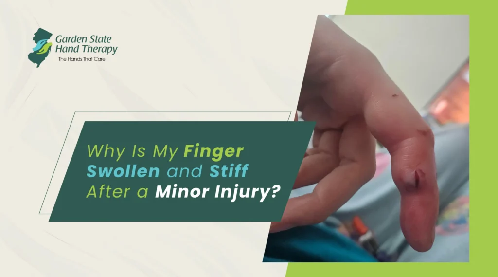 Why Is My Finger Swollen and Stiff After a Minor Injury